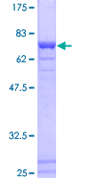 SF3B4 Protein - 12.5% SDS-PAGE of human SF3B4 stained with Coomassie Blue