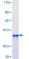 SF3B4 Protein - 12.5% SDS-PAGE Stained with Coomassie Blue.