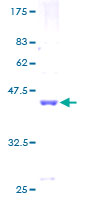 SF3B6 / SF3B14 Protein - 12.5% SDS-PAGE of human SF3B14 stained with Coomassie Blue