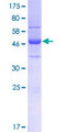 SFI1 Protein - 12.5% SDS-PAGE of human SFI1 stained with Coomassie Blue