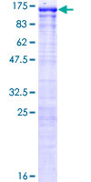 SFMBT1 Protein - 12.5% SDS-PAGE of human SFMBT1 stained with Coomassie Blue