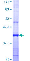 SFMBT1 Protein - 12.5% SDS-PAGE Stained with Coomassie Blue.