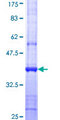 SFMBT1 Protein - 12.5% SDS-PAGE Stained with Coomassie Blue.
