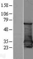 SFN / Stratifin / 14-3-3 Sigma Protein - Western validation with an anti-DDK antibody * L: Control HEK293 lysate R: Over-expression lysate