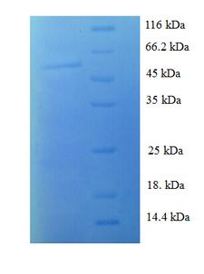 SFN / Stratifin / 14-3-3 Sigma Protein
