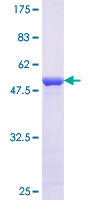 SFN / Stratifin / 14-3-3 Sigma Protein - 12.5% SDS-PAGE Stained with Coomassie Blue.