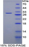 SFN / Stratifin / 14-3-3 Sigma Protein - Recombinant Stratifin By SDS-PAGE