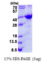 SFRP-3 / FRZB Protein