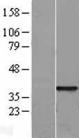 SFRP1 Protein - Western validation with an anti-DDK antibody * L: Control HEK293 lysate R: Over-expression lysate