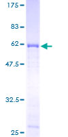 SFRP1 Protein - 12.5% SDS-PAGE of human SFRP1 stained with Coomassie Blue