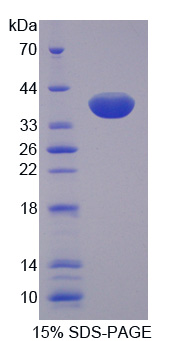 SFRP1 Protein - Recombinant Secreted Frizzled Related Protein 1 By SDS-PAGE