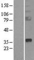 SFRP2 Protein - Western validation with an anti-DDK antibody * L: Control HEK293 lysate R: Over-expression lysate