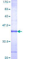 SFRP4 Protein - 12.5% SDS-PAGE Stained with Coomassie Blue.