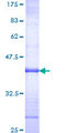 SFRP4 Protein - 12.5% SDS-PAGE Stained with Coomassie Blue.