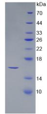 SFRP5 Protein - Recombinant Secreted Frizzled Related Protein 5 By SDS-PAGE