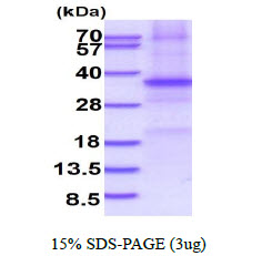 SFRP5 Protein