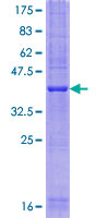 SFT2D1 Protein - 12.5% SDS-PAGE of human SFT2D1 stained with Coomassie Blue