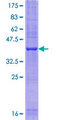 SFT2D1 Protein - 12.5% SDS-PAGE of human SFT2D1 stained with Coomassie Blue