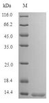 SFTA3 Protein - (Tris-Glycine gel) Discontinuous SDS-PAGE (reduced) with 5% enrichment gel and 15% separation gel.