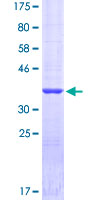 SFTPA1 / Surfactant Protein A Protein - 12.5% SDS-PAGE of human SFTPA1 stained with Coomassie Blue