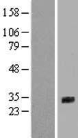 SFTPA2 / Surfactant Protein A2 Protein - Western validation with an anti-DDK antibody * L: Control HEK293 lysate R: Over-expression lysate