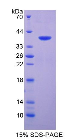 SFTPA2 / Surfactant Protein A2 Protein - Recombinant  Surfactant Associated Protein A2 By SDS-PAGE
