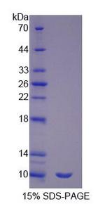 SFTPA2 / Surfactant Protein A2 Protein - Recombinant  Surfactant Associated Protein G By SDS-PAGE