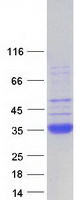 SFTPA2 / Surfactant Protein A2 Protein - Purified recombinant protein SFTPA2 was analyzed by SDS-PAGE gel and Coomassie Blue Staining