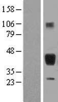 SFTPB / Surfactant Protein B Protein - Western validation with an anti-DDK antibody * L: Control HEK293 lysate R: Over-expression lysate
