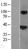 SFTPB / Surfactant Protein B Protein - Western validation with an anti-DDK antibody * L: Control HEK293 lysate R: Over-expression lysate