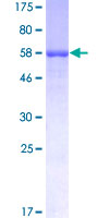 SFTPB / Surfactant Protein B Protein - 12.5% SDS-PAGE of human SFTPB stained with Coomassie Blue
