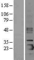 SFTPC / Surfactant Protein C Protein - Western validation with an anti-DDK antibody * L: Control HEK293 lysate R: Over-expression lysate