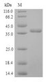 SFTPD / Surfactant Protein D Protein - (Tris-Glycine gel) Discontinuous SDS-PAGE (reduced) with 5% enrichment gel and 15% separation gel.