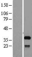 SFXN1 Protein - Western validation with an anti-DDK antibody * L: Control HEK293 lysate R: Over-expression lysate