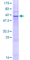 SFXN1 Protein - 12.5% SDS-PAGE of human SFXN1 stained with Coomassie Blue