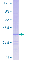 SFXN3 / Sideroflexin 3 Protein - 12.5% SDS-PAGE Stained with Coomassie Blue.