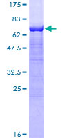 SGCA / DAG2 Protein - 12.5% SDS-PAGE of human SGCA stained with Coomassie Blue