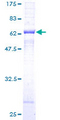 SGCB / SGC / Sarcoglycan Beta Protein - 12.5% SDS-PAGE of human SGCB stained with Coomassie Blue