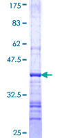 SGCB / SGC / Sarcoglycan Beta Protein - 12.5% SDS-PAGE Stained with Coomassie Blue.