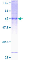 SGCD / Delta-Sarcoglycan Protein - 12.5% SDS-PAGE of human SGCD stained with Coomassie Blue