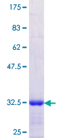 SGCD / Delta-Sarcoglycan Protein - 12.5% SDS-PAGE Stained with Coomassie Blue.