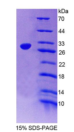 SGCD / Delta-Sarcoglycan Protein - Recombinant  Sarcoglycan Delta By SDS-PAGE