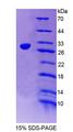 SGCD / Delta-Sarcoglycan Protein - Recombinant  Sarcoglycan Delta By SDS-PAGE