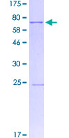 SGCE Protein - 12.5% SDS-PAGE of human SGCE stained with Coomassie Blue