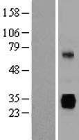 SGCG / Gamma-Sarcoglycan Protein - Western validation with an anti-DDK antibody * L: Control HEK293 lysate R: Over-expression lysate