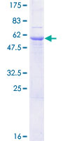 SGCG / Gamma-Sarcoglycan Protein - 12.5% SDS-PAGE of human SGCG stained with Coomassie Blue