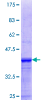 SGCG / Gamma-Sarcoglycan Protein - 12.5% SDS-PAGE Stained with Coomassie Blue.
