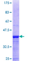 SGCG / Gamma-Sarcoglycan Protein - 12.5% SDS-PAGE Stained with Coomassie Blue.