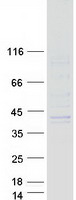 SGCG / Gamma-Sarcoglycan Protein - Purified recombinant protein SGCG was analyzed by SDS-PAGE gel and Coomassie Blue Staining