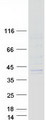 SGCG / Gamma-Sarcoglycan Protein - Purified recombinant protein SGCG was analyzed by SDS-PAGE gel and Coomassie Blue Staining